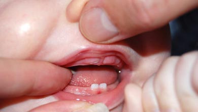 کمک کردن به کودکی که دندان در می‌آورد