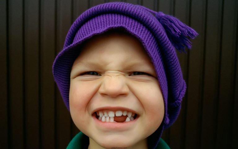 زود از دست رفتن دندان‌های شیری چه عوارضی دارد؟