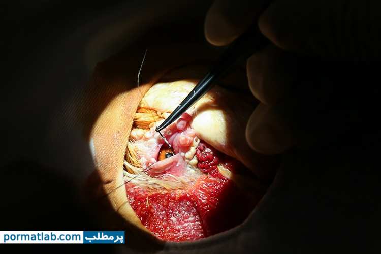 عمل جراحی آب مروارید روی چشم خروس- پرمطلب